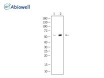 GFAP Recombinant Mouse Monoclonal Antibody