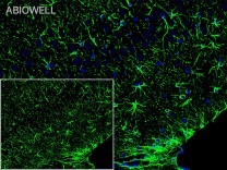 GFAP Recombinant Mouse Monoclonal Antibody