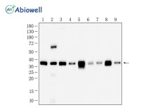 PDXK Mouse Monoclonal Antibody