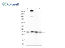 SOD2 Rabbit Polyclonal Antibody