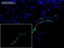 VWF Recombinant Rabbit Monoclonal Antibody