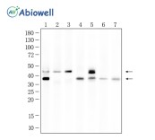 CEBPB Rabbit Polyclonal Antibody