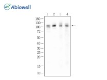 Hexokinase 2 Recombinant Rabbit Monoclonal Antibody