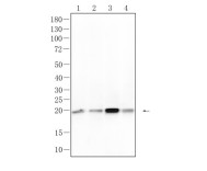 Ferritin Recombinant Rabbit Monoclonal  Antibody