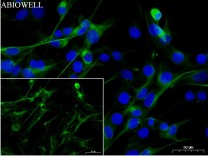 β-Tubulin Recombinant Rabbit Monoclonal Antibody