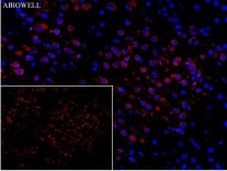 SQSTM1/p62 Mouse Monoclonal Antibody