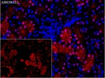 GPX4 Recombinant Rabbit Monoclonal Antibody