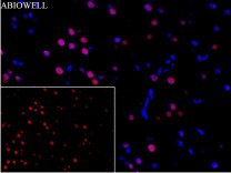 Caspase-8 Recombinant Rabbit Monoclonal Antibody