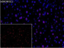 Caspase-8 Recombinant Rabbit Monoclonal Antibody