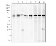 SQSTM1/p62 Recombinant Rabbit Monoclonal Antibody