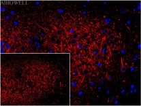 Beclin 1 Recombinant Rabbit Monoclonal Antibody