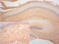 Beclin 1 Recombinant Rabbit Monoclonal Antibody