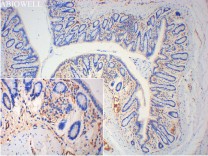 Beclin 1 Recombinant Rabbit Monoclonal Antibody