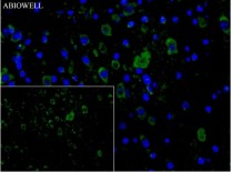 Caspase-1 Recombinant Rabbit Monoclonal Antibody