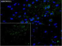 Caspase-1 Recombinant Rabbit Monoclonal Antibody