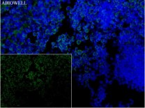 Caspase-1 Recombinant Rabbit Monoclonal Antibody