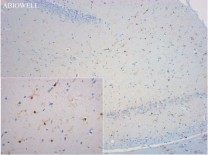 Iba1 Recombinant Rabbit Monoclonal Antibody