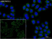 ATG7 Recombinant Rabbit Monoclonal  Antibody