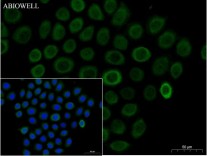 Ubiquitin Recombinant Rabbit Monoclonal Antibody