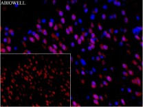 Ubiquitin Recombinant Rabbit Monoclonal Antibody