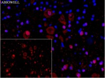 Ubiquitin Recombinant Rabbit Monoclonal Antibody