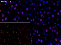 Ubiquitin Recombinant Rabbit Monoclonal Antibody