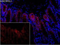 Beclin 1 Recombinant Rabbit Monoclonal Antibody