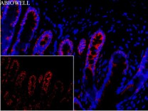 Beclin 1 Recombinant Rabbit Monoclonal Antibody