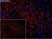 Beclin 1 Recombinant Rabbit Monoclonal Antibody