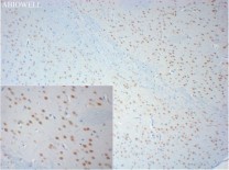 HDAC3 Recombinant Rabbit Monoclonal  Antibody