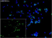 CD86 Recombinant Rabbit Monoclonal Antibody