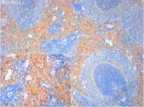 CD86 Recombinant Rabbit Monoclonal Antibody