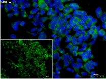 ULK1 Recombinant Rabbit Monoclonal   Antibody