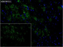 ULK1 Recombinant Rabbit Monoclonal   Antibody