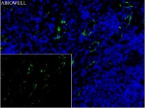 ULK1 Recombinant Rabbit Monoclonal   Antibody