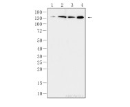 JAK1 Recombinant Rabbit Monoclonal  Antibody