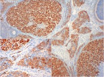 APAF1 Rabbit Polyclonal Antibody