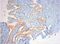 AKT1/2/3 Rabbit Polyclonal Antibody