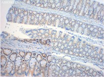 PPARA Rabbit Polyclonal Antibody