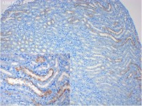 PPARA Rabbit Polyclonal Antibody