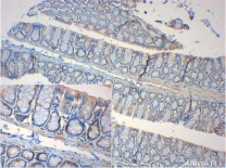 PPARγ Rabbit Polyclonal Antibody