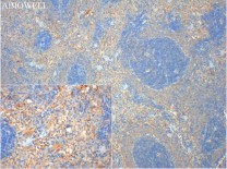 CD45 Rabbit Polyclonal Antibody