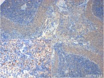 GAPDH Rabbit Polyclonal Antibody