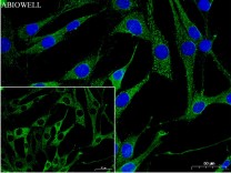 CEBPB Rabbit Polyclonal Antibody