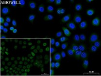 Bax Recombinant Rabbit Monoclonal Antibody