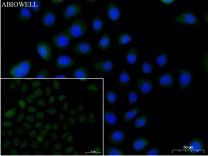 GPX4 Recombinant Rabbit Monoclonal Antibody