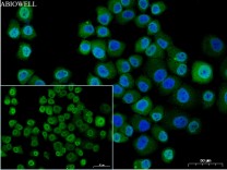 STAT3(Phospho Ser727) Recombinant Rabbit Monoclonal Antibody