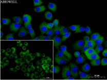 ATG7 Recombinant Rabbit Monoclonal  Antibody