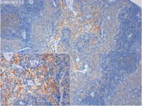 CD63 Rabbit Polyclonal Antibody