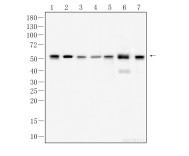 β-Tubulin Mouse Monoclonal Antibody